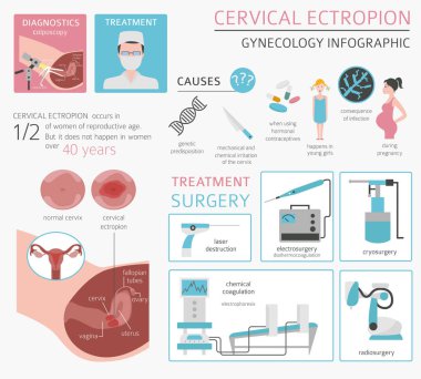 Servikal ectropion. Ginecological tıbbi desease Infographic. Vektör çizim