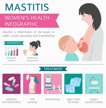 Mastit, emzirmek, tıbbi Infographic. Teşhis, belirtileri, tedavisi. Kadın sağlık simge seti. Vektör çizim
