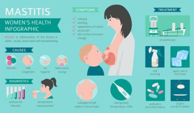 Mastitis, breastfeed, medical infographic. Diagnostics, symptoms, treatment. Women`s health icon set. Vector illustration clipart