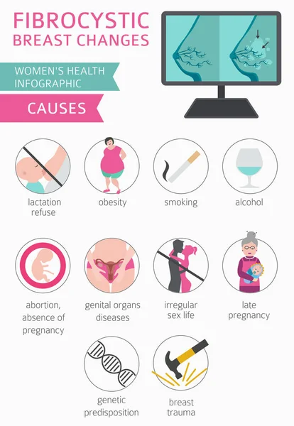 Seno Fibrocistico Cambia Malattia Infografica Medica Diagnostica Sintomi Trattamento Set — Vettoriale Stock