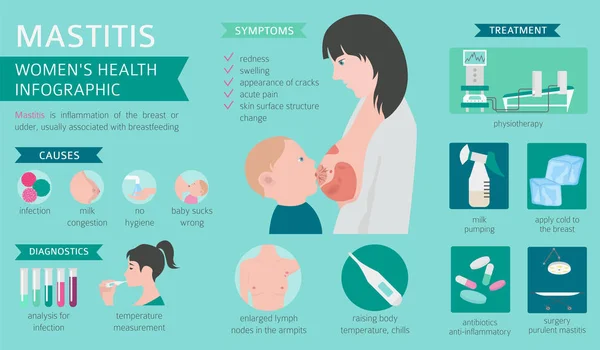 Mastitis Lactancia Materna Infografía Médica Diagnósticos Síntomas Tratamiento Conjunto Iconos — Vector de stock