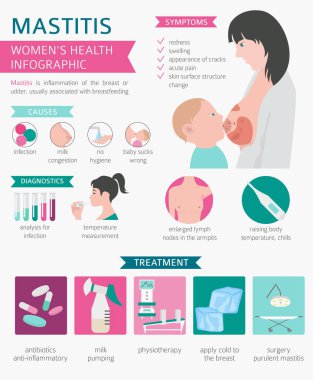 Mastit, emzirmek, tıbbi Infographic. Teşhis, belirtileri, tedavisi. Kadın sağlık simge seti. Vektör çizim