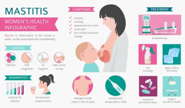 Mastitis, breastfeed, medical infographic. Diagnostics, symptoms, treatment. Women`s health icon set. Vector illustration clipart