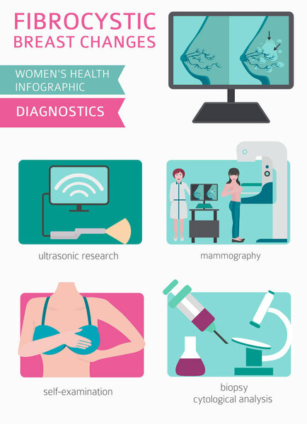Fibrocystic breast changes disease, medical infographic. Diagnostics, symptoms, treatment. Women`s health icon set. Vector illustration