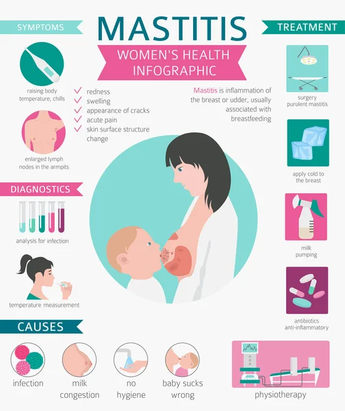 Mastitis Stillen Medizinische Infografik Diagnose Symptome Behandlung Frauen Gesundheitsikone Gesetzt — Stockvektor