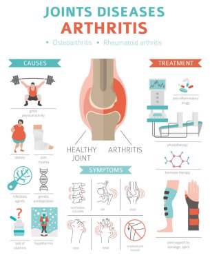 Eklem hastalıkları. Artrit belirtileri, tedavisi Icon set. Tıbbi Infographic tasarım. Vektör çizim