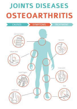 Eklem hastalıkları. Artrit, osteoartrit belirtileri, tedavisi Icon set. Tıbbi Infographic tasarım. Vektör çizim