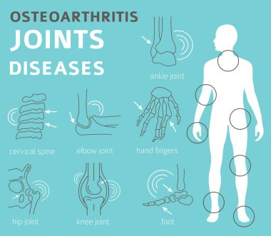 Eklem hastalıkları. Artrit, osteoartrit belirtileri, tedavisi Icon set. Tıbbi Infographic tasarım. Vektör çizim