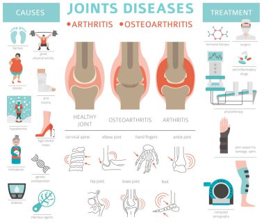 Eklem hastalıkları. Artrit, osteoartrit belirtileri, tedavisi Icon set. Tıbbi Infographic tasarım. Vektör çizim