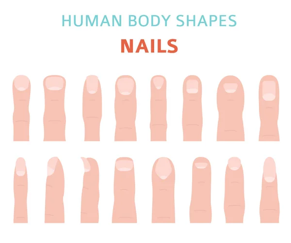Formas Corpo Humano Mão Unha Tipos Definido Ilustração Vetorial — Vetor de Stock