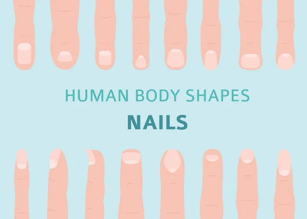 Formes Corps Humain Types Ongles Doigt Main Ensemble Illustration Vectorielle — Image vectorielle