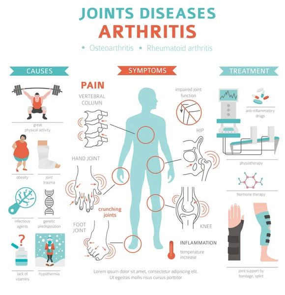 Enfermedades Articulares Síntomas Artritis Conjunto Iconos Tratamiento Diseño Infografía Médica — Archivo Imágenes Vectoriales