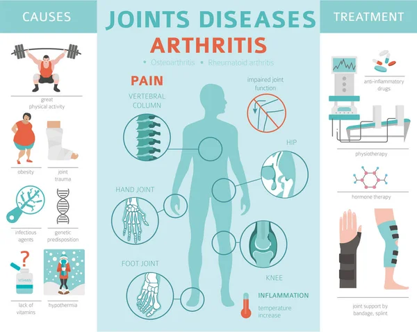 Enfermedades Articulares Síntomas Artritis Conjunto Iconos Tratamiento Diseño Infografía Médica — Vector de stock