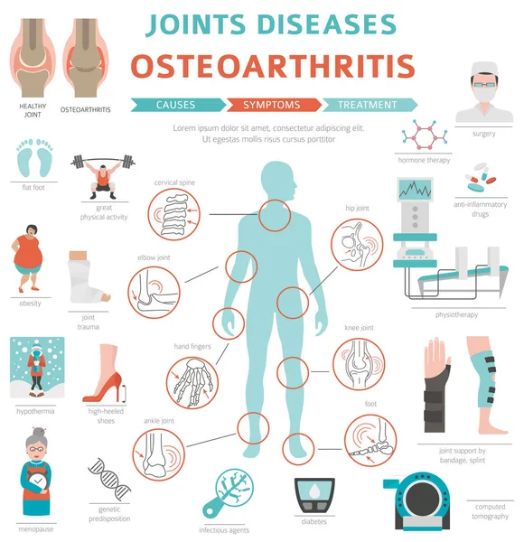 Enfermedades Articulares Artritis Síntomas Osteoartritis Conjunto Iconos Tratamiento Diseño Infografía — Vector de stock