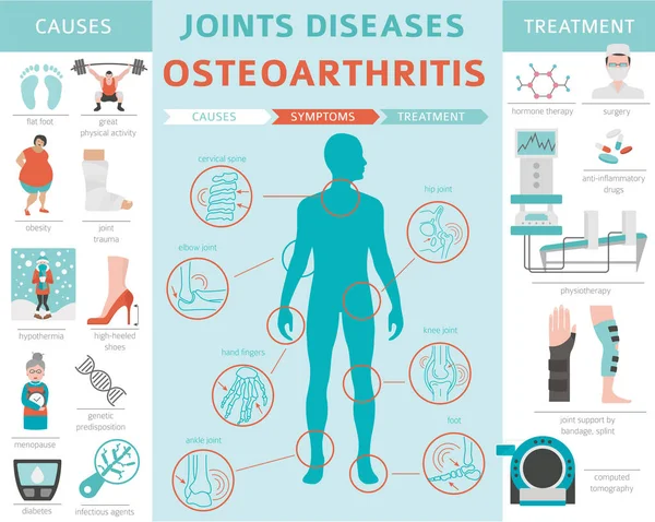 Eklem Hastalıkları Artrit Osteoartrit Belirtileri Tedavisi Icon Set Tıbbi Infographic — Stok Vektör