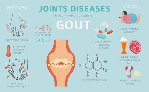Eklem Hastalıkları Gut Belirtileri Tedavisi Icon Set Tıbbi Infographic Tasarım — Stok Vektör