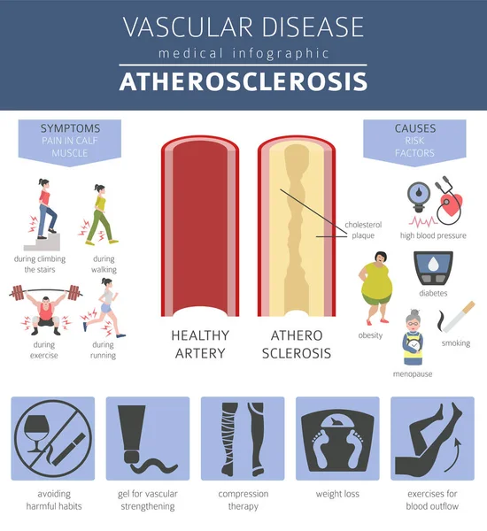 Vasculaire Ziekten Atherosclerose Symptomen Behandeling Pictogramserie Medische Infographic Ontwerp Vectorillustratie — Stockvector