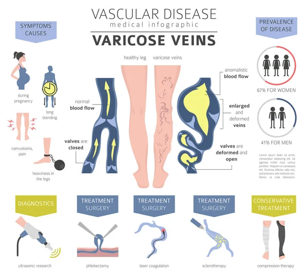 Vascular Diseases Varicose Veins Symptoms Treatment Icon Set Medical Infographic — Stock Vector