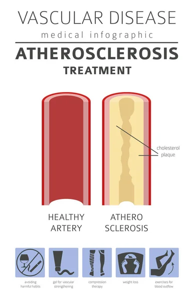 Doenças vasculares. Sintomas de aterosclerose, conjunto de ícones de tratamento . — Vetor de Stock