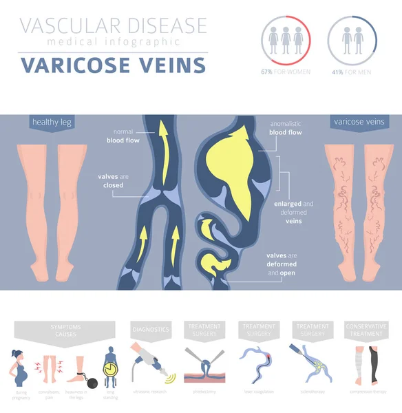 Doenças Vasculares Sintomas Varizes Conjunto Ícones Tratamento Projeto Infográfico Médico — Vetor de Stock