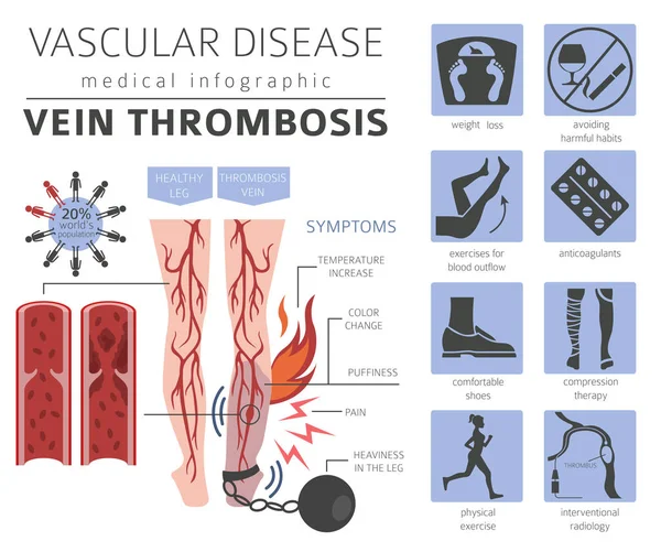 Enfermedades Vasculares Síntomas Trombosis Venosa Conjunto Iconos Tratamiento Diseño Infografía — Vector de stock