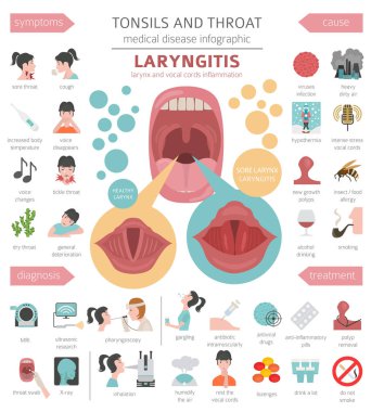 Tonsils and throat diseases. Laryngitis symptoms, treatment icon set. Medical infographic design. Vector illustration clipart