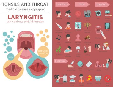 Bademcik ve boğaz hastalıkları. Larenjit belirtiler, tedavi Icon set. Tıbbi Infographic tasarım. Vektör çizim
