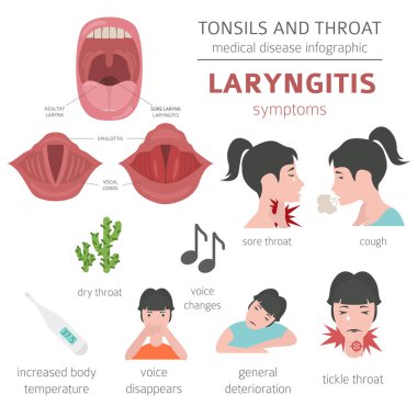 Bademcik ve boğaz hastalıkları. Larenjit belirtiler, tedavi Icon set. Tıbbi Infographic tasarım. Vektör çizim