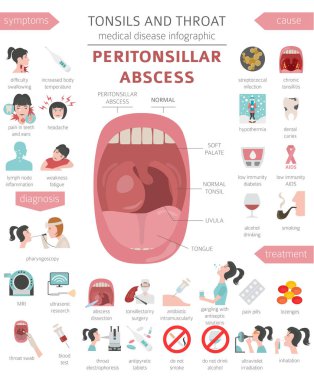 Tonsils and throat diseases. Peritonsillar abscess symptoms, treatment icon set. Medical infographic design. Vector illustration clipart