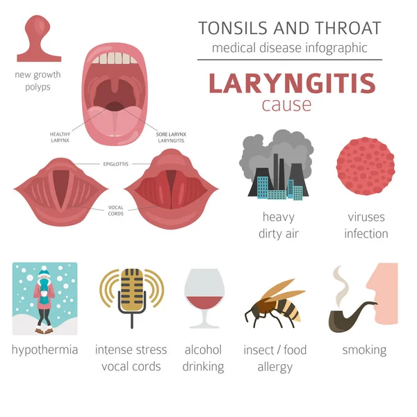 Amígdalas Enfermedades Garganta Síntomas Laringitis Conjunto Iconos Tratamiento Diseño Infografía — Vector de stock