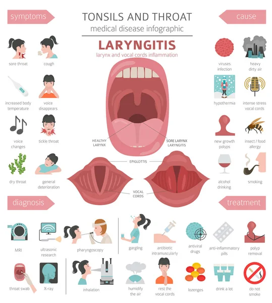扁桃体和咽喉疾病 喉炎症状 治疗图标集 医疗信息图设计 向量例证 — 图库矢量图片