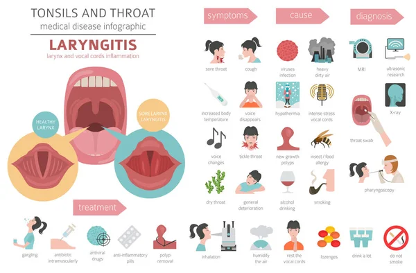 Amandelen Keel Ziekten Laryngitis Symptomen Behandeling Pictogramserie Medische Infographic Ontwerp — Stockvector