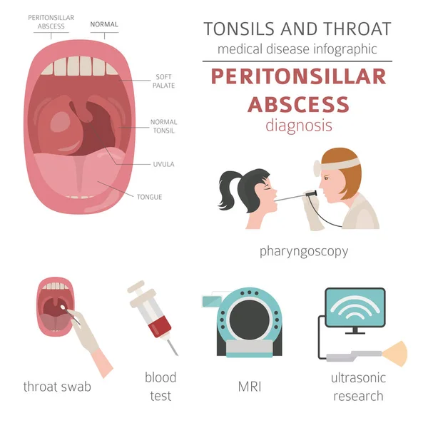 Tonsils Throat Diseases Peritonsillar Abscess Symptoms Treatment Icon Set Medical — Stock Vector