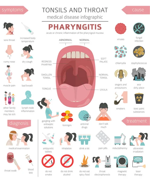 Amígdalas Enfermedades Garganta Síntomas Faringitis Conjunto Iconos Tratamiento Diseño Infografía — Vector de stock