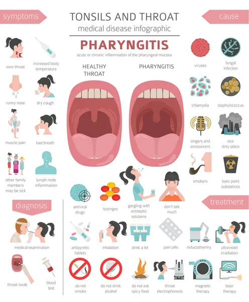 Tonsilas Doenças Garganta Sintomas Faringite Conjunto Ícones Tratamento Projeto Infográfico —  Vetores de Stock