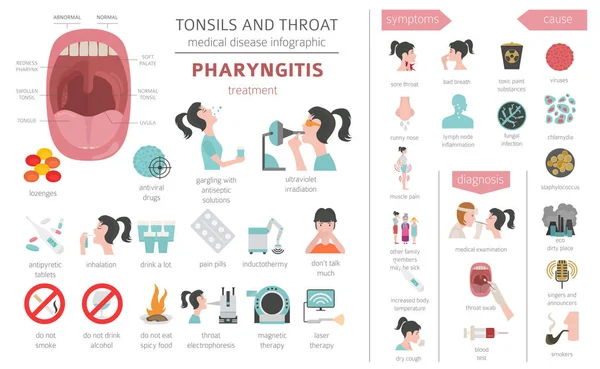 Amandelen Keel Ziekten Faryngitis Symptomen Behandeling Pictogramserie Medische Infographic Ontwerp — Stockvector