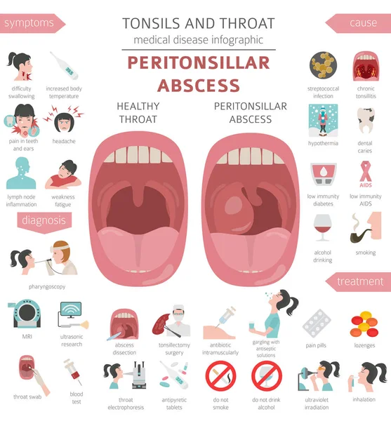 扁桃体和咽喉疾病 腹膜脓肿症状 治疗图标集 医疗信息图设计 向量例证 — 图库矢量图片