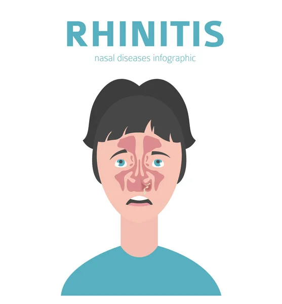 Doenças nasais. Sintomas de rinite, conjunto de ícone de tratamento. Médico i —  Vetores de Stock