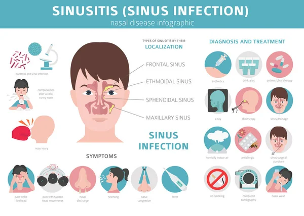 Maladies nasales. Sinusite, infection sinusale diagnostic et traitement — Image vectorielle
