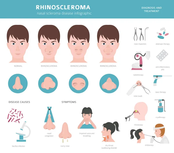 Nasal diseases. Rhinoscleroma symptoms, nasal scleroma treatment — Stock Vector