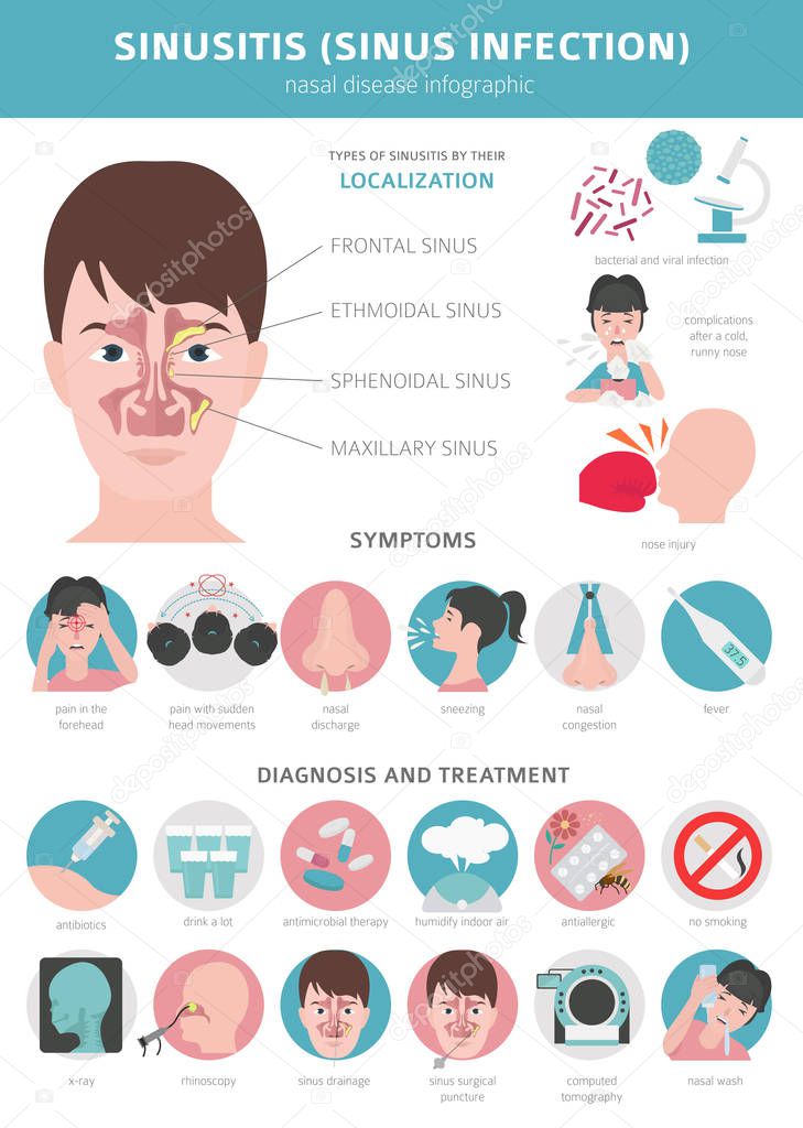 Nasal diseases. Sinusitis, sinus infection diagnosis and treatme