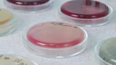 Kan testi. Mikrobiyoloji Laboratuvarı. Bilim adamı Petri Tabaklarıyla Çalışıyor.