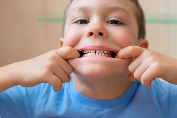 Ребенок растягивает рот и показывает зубы — стоковое фото