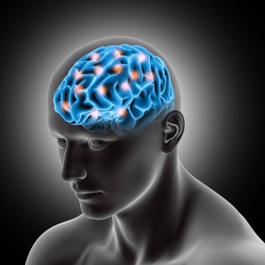 3D render of a male medical figure showing brain with highlights clipart