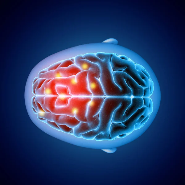 Imagen médica en 3D que muestra la vista superior de un cerebro con partes destacadas —  Fotos de Stock