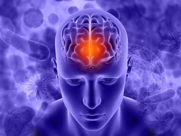 3D medizinisches Bild mit männlicher Figur mit Gehirn auf Viren hervorgehoben — Stockfoto