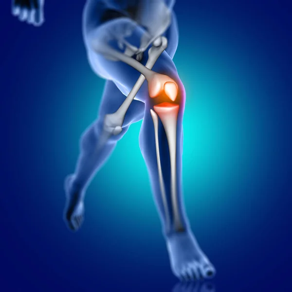 膝骨と実行している男性の医療フィギュアの3Dレンダリングが強調 — ストック写真