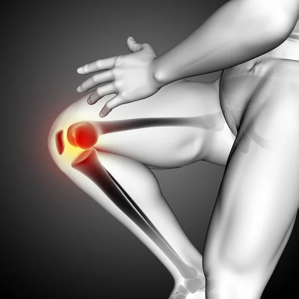 膝骨近端男性医学形象的3D渲染 — 图库照片