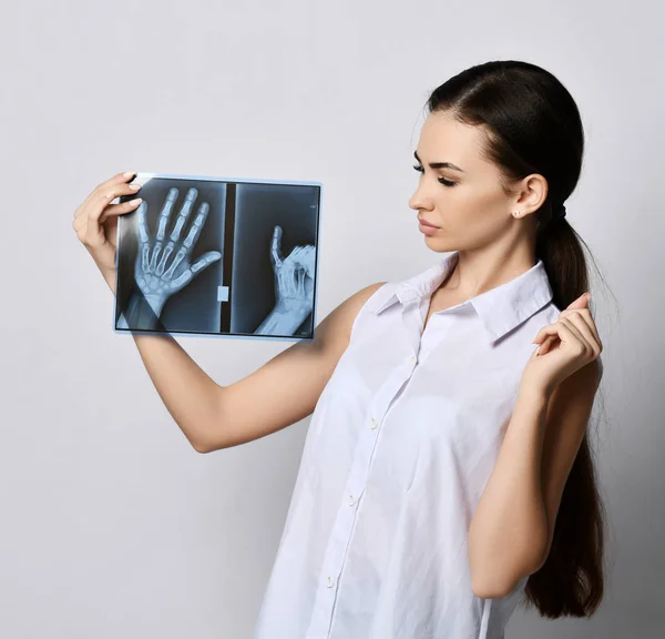 Strongly puzzled brunette woman doctor or clinic patient looks at hands X-ray examination — Stock Photo, Image