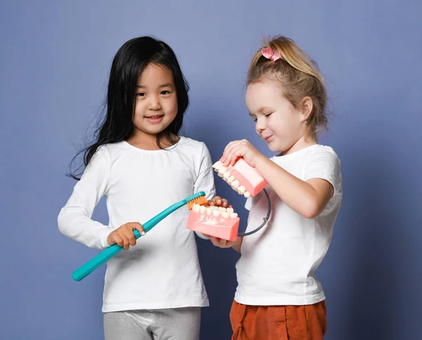 Two children friends with toothbrushes hold big dental implant model try to brush teeth. Oral hygiene and moth health — Stock Photo, Image